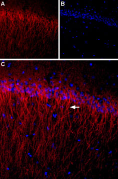 Expression of CACNB1 (Ca V β1) in rat hippocampus