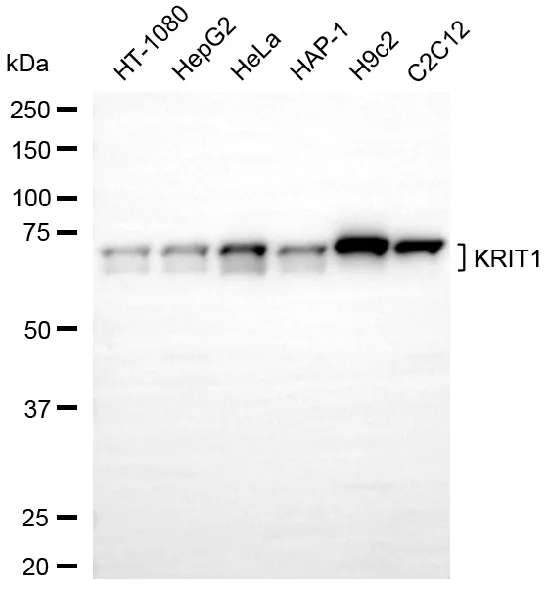 KVAb00335