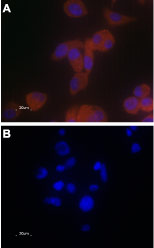 Expression of TRPV6 in PC-3 cells