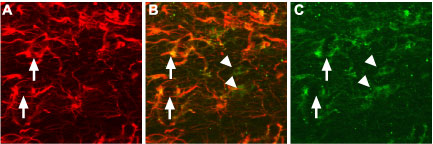 Expression of proNGF in rat brain sections