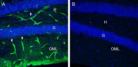 Expression of MERTK in mouse hippocampus