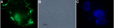 Expression of PAR-4 in a human breast adenocarcinoma cell line
