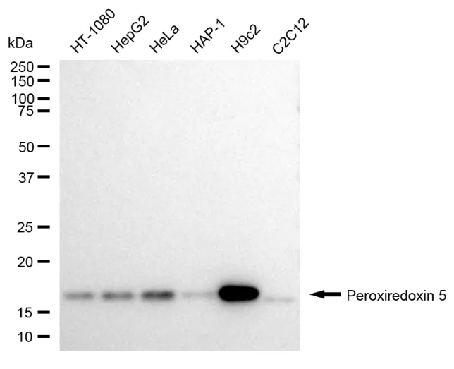 KVAb00955