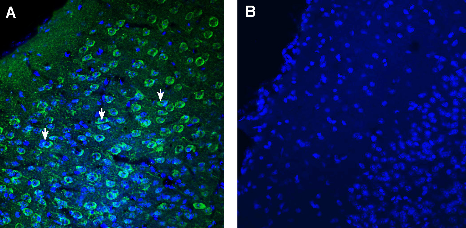 Expression of TMEM175 in mouse piriform cortex.