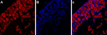 Expression of P2RX3 in rat DRG