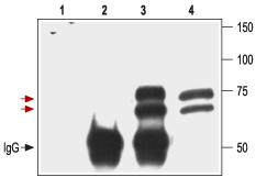 Immunoprecipitation of 3T3/p75 NTR transfected cells: