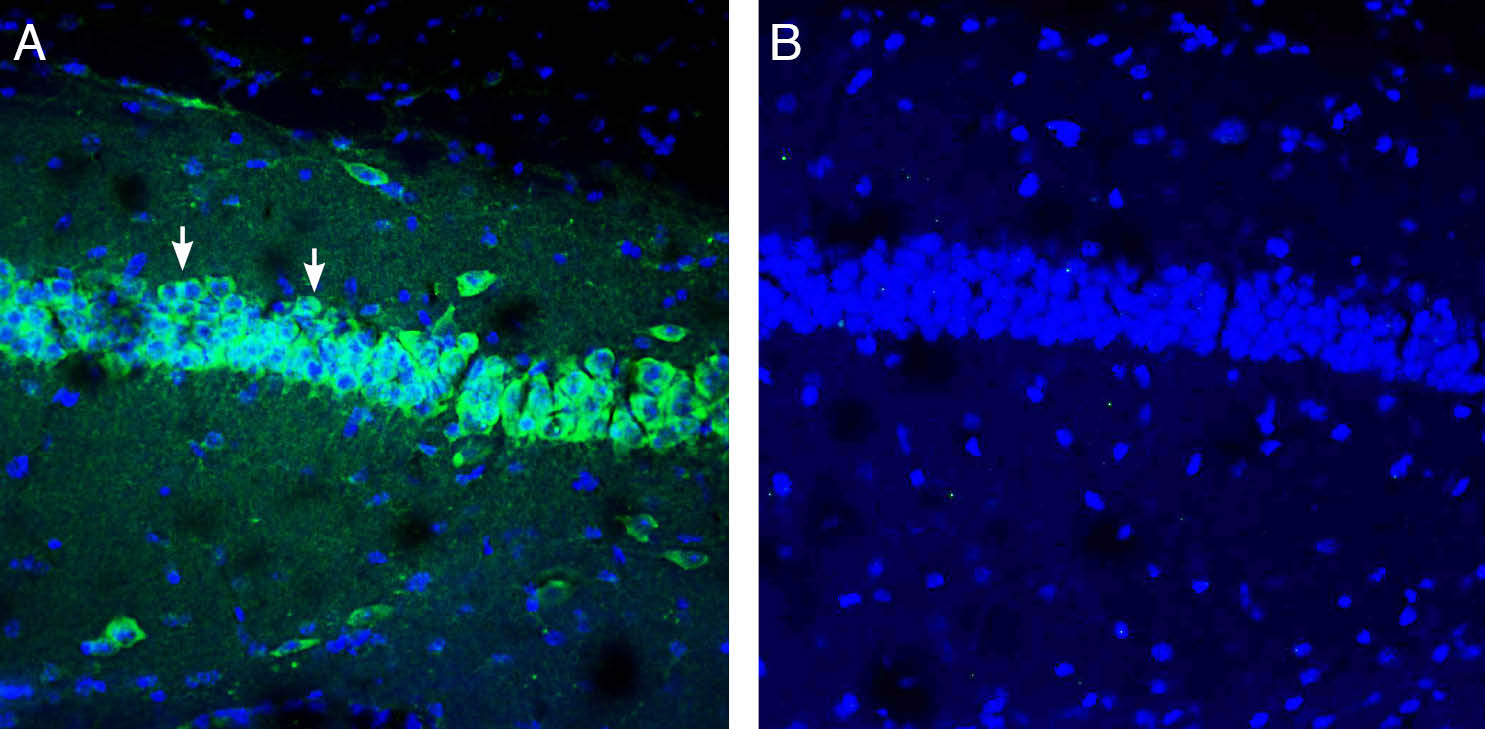 Expression of IGF1 in mouse hippocampus.