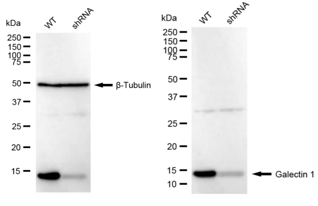 KVAb01041