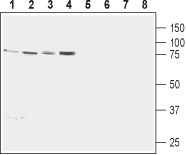 Western blot analysis of rat heart membrane (lanes 1 and 5), mouse heart membrane (lanes 2 and 6), human breast adenocarcinoma (MCF7) lysate (lanes 3 and 7) and human ovary adenocarcinoma (OVCAR-3) cell line lysate (lanes 4 and 8):