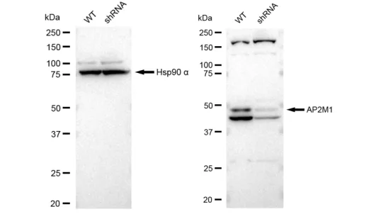 KVAb01418