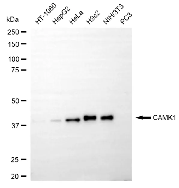 KVAb00151