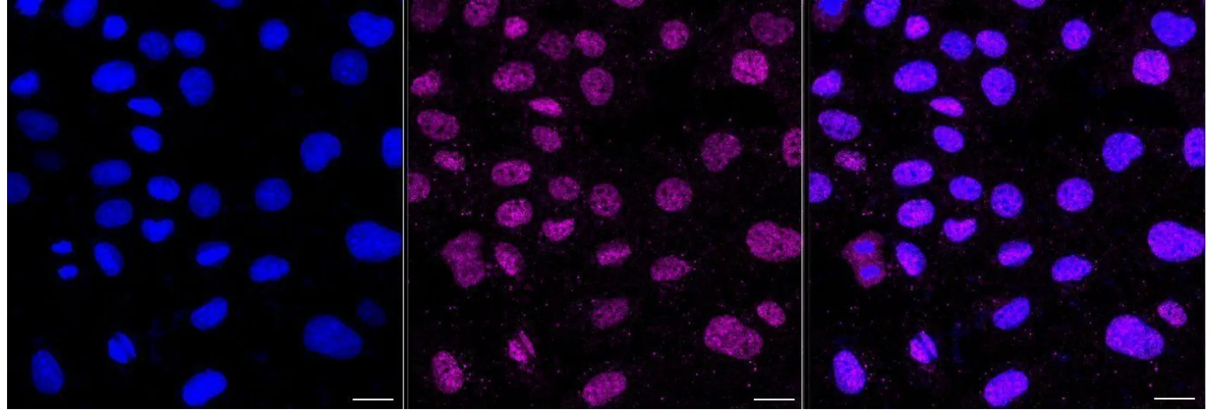 KVAb01554