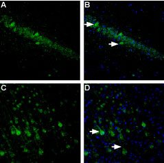 Expression of NLGN1 in rat hippocampus and cortex