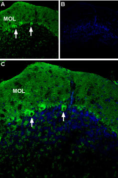 Expression of P2X1 receptor in mouse cerebellum
