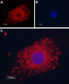 Expression of TRPP1 (PKD2) in C2C12 cell line