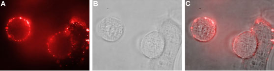 Expression of NHE1 in human MCF-7 cells