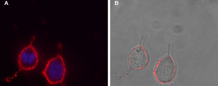 Expression of P2RY12 in human glioblastoma (U-87 MG) cells