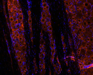 Expression of GDNF in rat dorsal root ganglion (DRG).