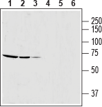 Western blot analysis of rat skeletal muscle lysate (lanes 1 and 4, 1:600), mouse brain membrane (lanes 2 and 5) and human OVCAR3 ovarian adenocarcinoma cell line lysate (lanes 3 and 6):