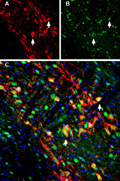 Multiplex staining of GIRK2 (K ir 3.2) and LRRK2 in mouse substantia nigra pars compacta