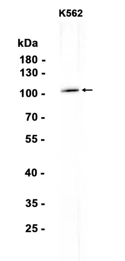 AMRe87051