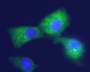 Expression of K ir 4.1 in human U-87 MG glioblastoma cell line