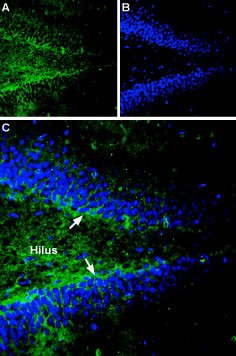Expression of Gephyrin in rat hippocampus