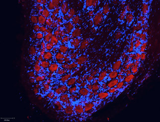 Expression of NMDAR2B (NR2B) in rat DRG