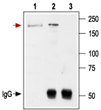 Immunoprecipitation of rat brain lysates:
