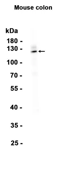 AMRe86869