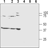 Western blot analysis of rat brain membranes (lanes 1 and 4), mouse brain membranes (lanes 2 and 5) and human SH-SY5Y neuroblastoma cell lysates (lanes 3 and 6):