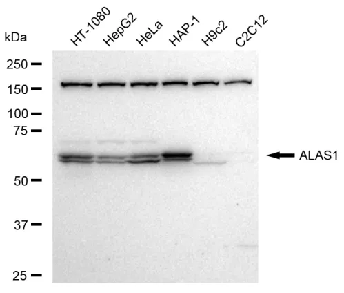KVAb01616