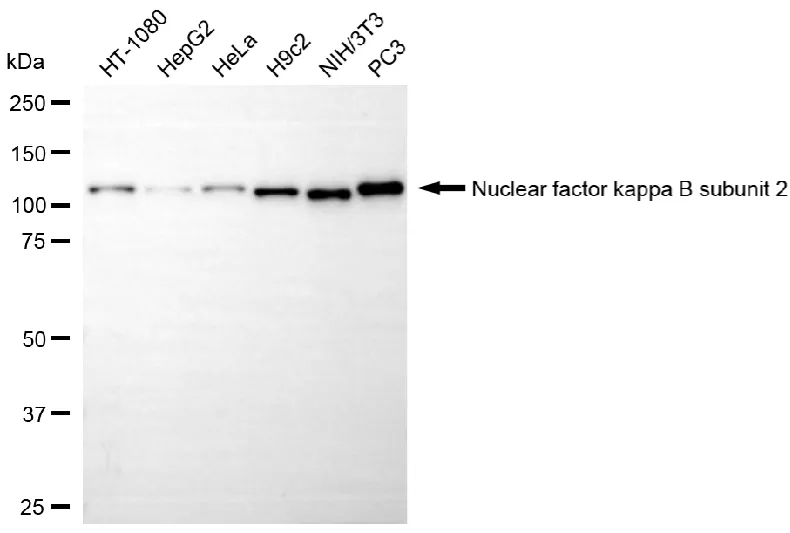 KVAb01395