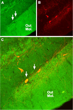 Expression of NR2A in rat hippocampus