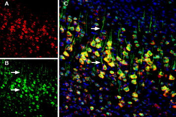 Multiplex staining of Calnexin and Presenilin-1 in mouse cortex