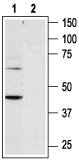 Western blot analysis of rat heart membranes: