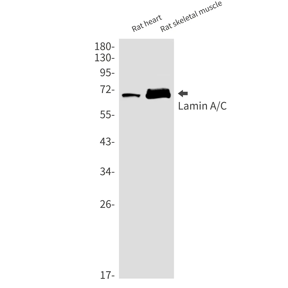 AMRe02200