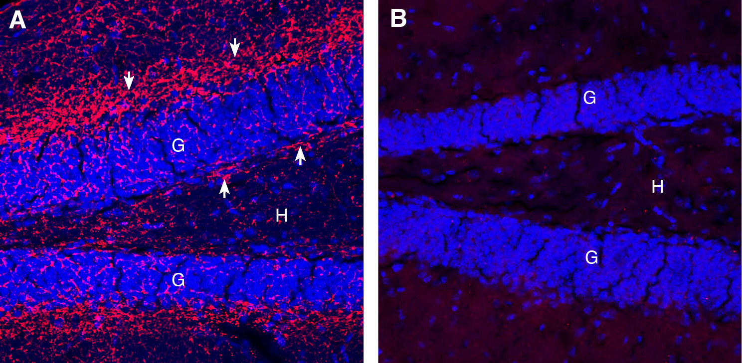 Expression of Cannabinoid Receptor 1 in mouse hippocampus.