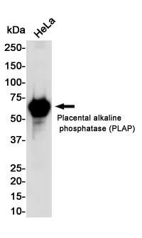 AMRe04101
