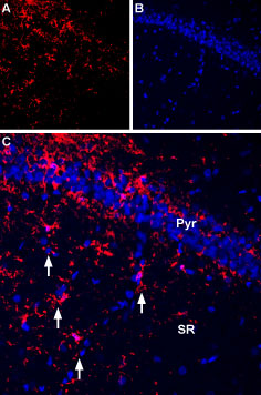 Expression of P2RX7 in rat hippocampus