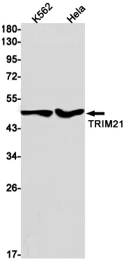 AMRe02716