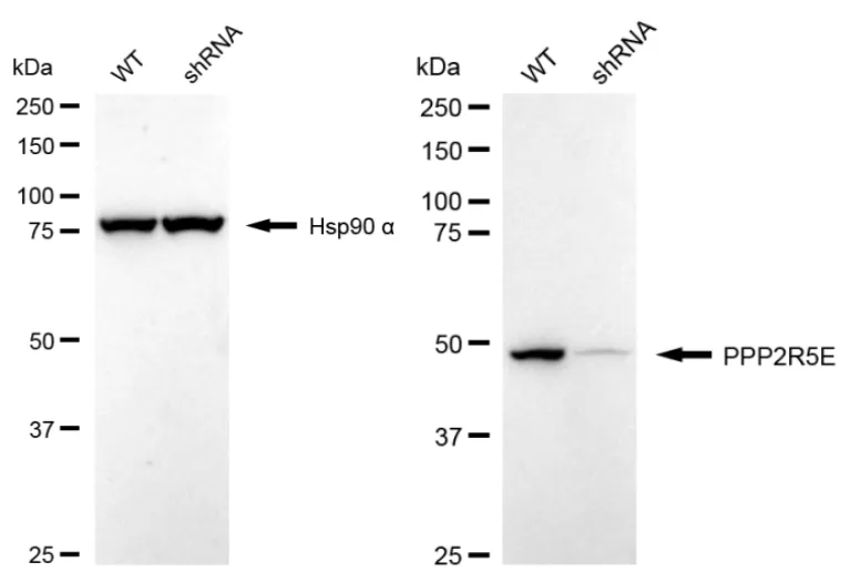 KVAb00939