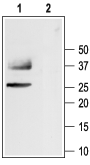 Western blot analysis of rat kidney membranes: