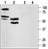 Western blot analysis of rat lung (lanes 1 and 3) and testis (lanes 2 and 4) lysates: