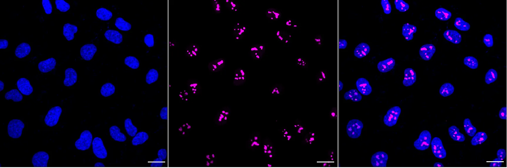KVAb01597