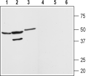 Western blot analysis of rat brain (lanes 1 and 4) kidney (lanes 2 and 5) and heart (lanes 3 and 6) membranes: