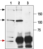 Immunoprecipitation of rat brain lysates