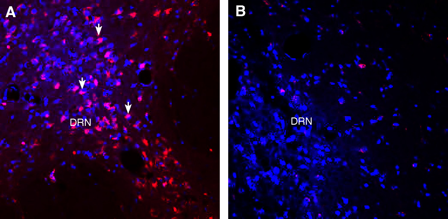 Expression of VGLUT1 in mouse dorsal root nucleus (DRN).