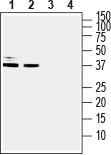 Western blot analysis of human U-87 MG glioblastoma cell line lysate (lanes 1 and 3) and human HT-29 colorectal adenocarcinoma cell line lysate (lanes 2 and 4):