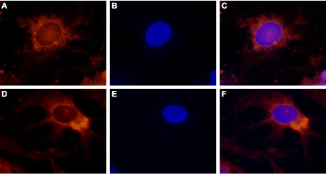 Expression of TRPV4 in rat DRG primary culture